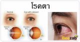 โรคตา โรคสายตา โรคหนังตา โรคเกี่ยวกับตา