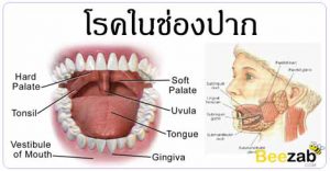 โรคในช่องปาก โรคเหงือก โรคฟัน โรคเกี่ยวกับฟัน