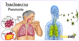 โรคปอดบวม โรคระบบทาเดินหายใจ โรคติดเชื้อ โรคปอด