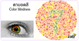 ตาบอดสี โรคตา โรคเกี่ยวกับดวงตา โรคไม่ติดต่อ