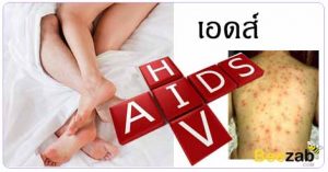 โรคเอดส์ ติดเชื้อไวรัสเอชไอวี โรคติดต่อ โรคติดต่อทางเพศสัมพันธ์