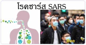ซาร์ส SARS ไข้หวัดมรณะ โรคติดต่อ