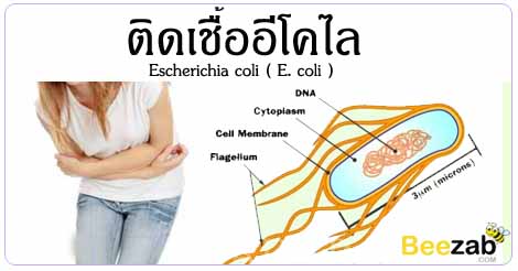E.Coli โรค การติดเชื้อแบคทีเรีย แบคทีเรียอีโคไล